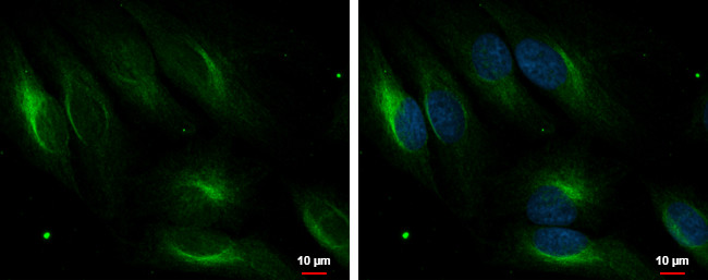 PDLIM4 Antibody in Immunocytochemistry (ICC/IF)