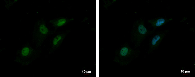MTA2 Antibody in Immunocytochemistry (ICC/IF)