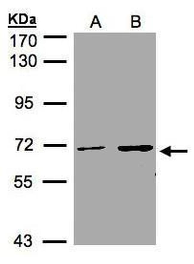 CDYL Antibody in Western Blot (WB)