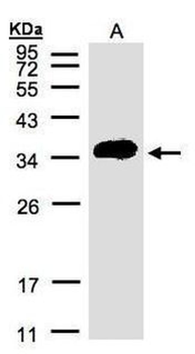 ATP6IP2 Antibody in Western Blot (WB)