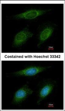 RNF6 Antibody in Immunocytochemistry (ICC/IF)