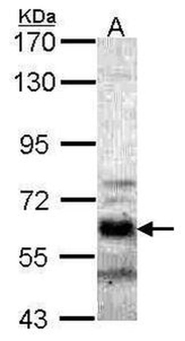 PPP2R5A Antibody in Western Blot (WB)