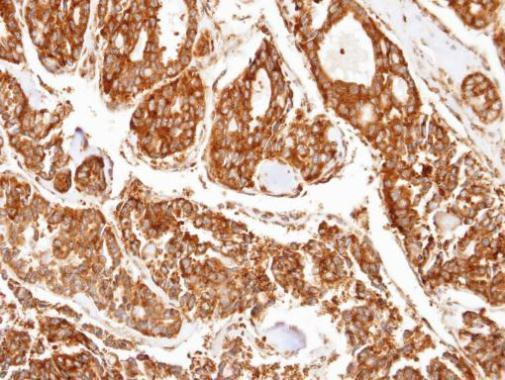 PPP2R5D Antibody in Immunohistochemistry (Paraffin) (IHC (P))