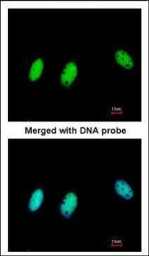 HP1 beta Antibody in Immunocytochemistry (ICC/IF)