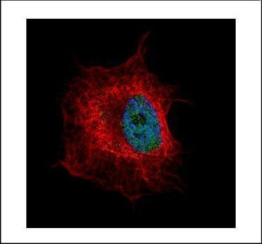 NUP50 Antibody in Immunocytochemistry (ICC/IF)