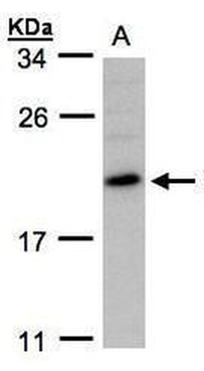 HP1 gamma Antibody in Western Blot (WB)