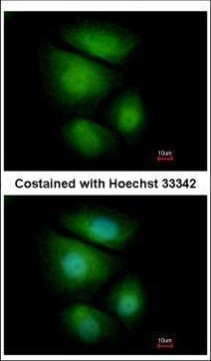 RNF13 Antibody in Immunocytochemistry (ICC/IF)