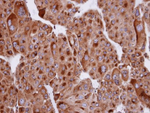 SERTAD1 Antibody in Immunohistochemistry (Paraffin) (IHC (P))