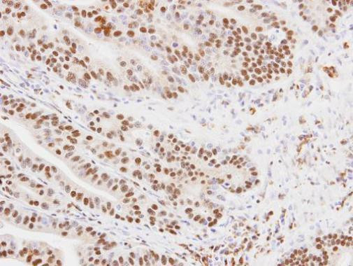 MKRN1 Antibody in Immunohistochemistry (Paraffin) (IHC (P))