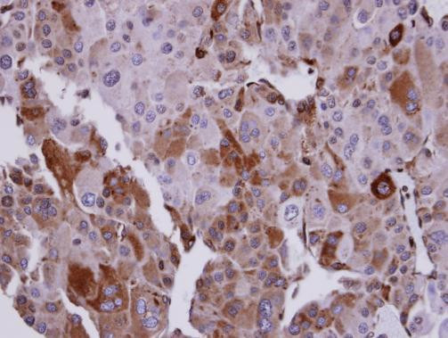 UBE2T Antibody in Immunohistochemistry (Paraffin) (IHC (P))