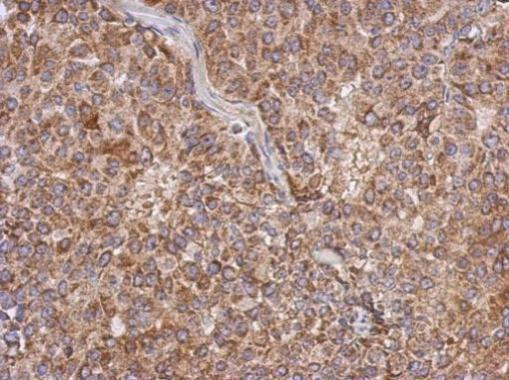 Apolipoprotein L1 Antibody in Immunohistochemistry (Paraffin) (IHC (P))