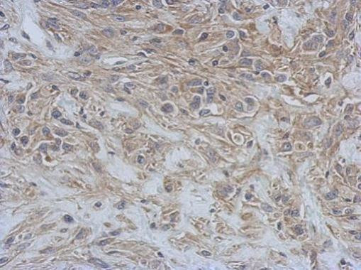 RAP1GDS1 Antibody in Immunohistochemistry (Paraffin) (IHC (P))