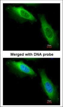 EEF1B2 Antibody in Immunocytochemistry (ICC/IF)