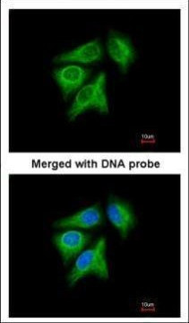 p40 Antibody in Immunocytochemistry (ICC/IF)