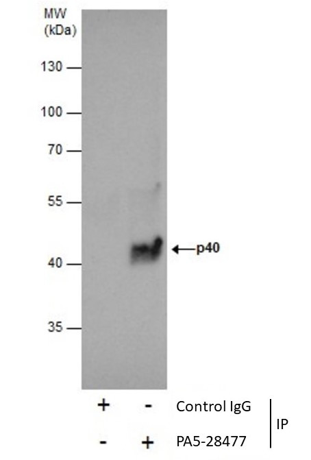 p40 Antibody in Immunoprecipitation (IP)