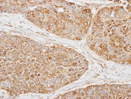 MRPS22 Antibody in Immunohistochemistry (Paraffin) (IHC (P))