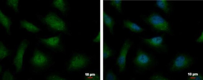 PSMB9 Antibody in Immunocytochemistry (ICC/IF)