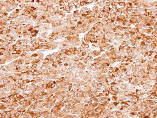 AKR7A3 Antibody in Immunohistochemistry (Paraffin) (IHC (P))