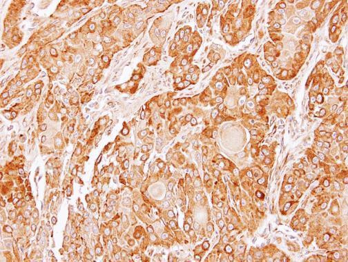 ERP44 Antibody in Immunohistochemistry (Paraffin) (IHC (P))