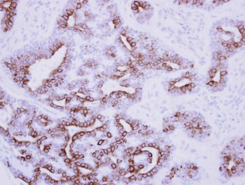 Nodal Antibody in Immunohistochemistry (Paraffin) (IHC (P))