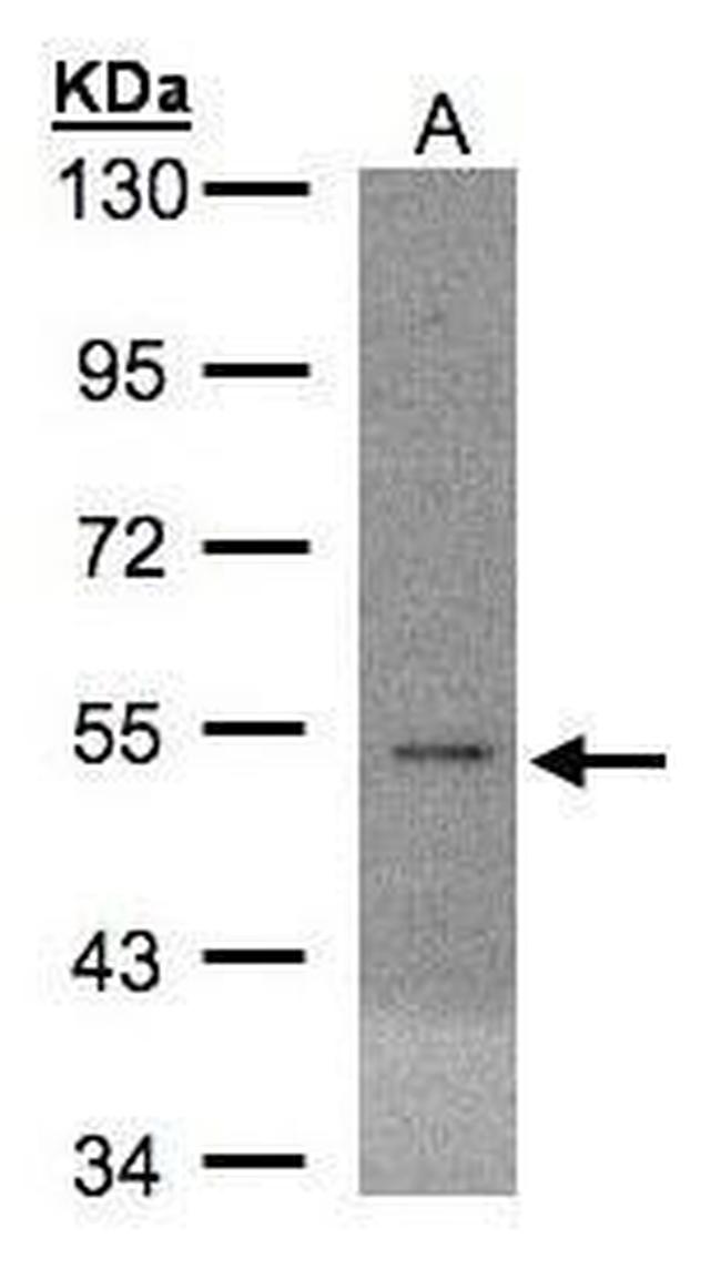 eIF5 Antibody in Western Blot (WB)