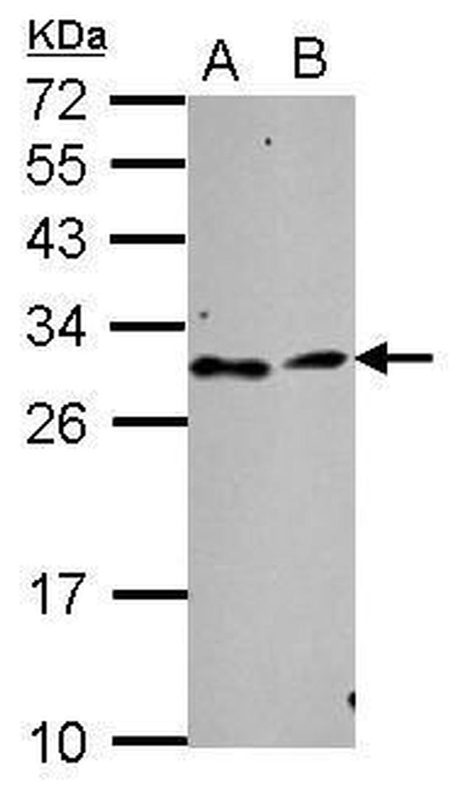 TATDN3 Antibody in Western Blot (WB)