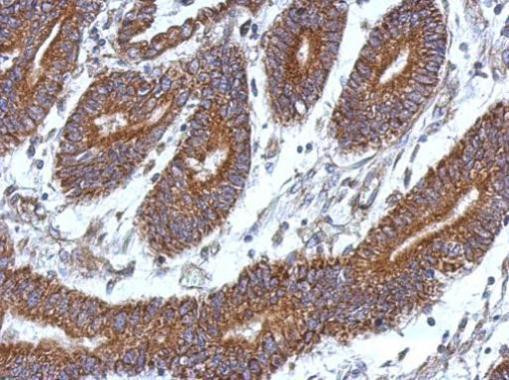 CCDC37 Antibody in Immunohistochemistry (Paraffin) (IHC (P))