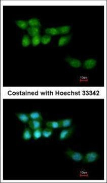 KIAA1530 Antibody in Immunocytochemistry (ICC/IF)