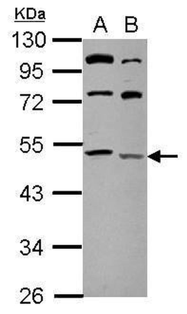 LCLAT1 Antibody in Western Blot (WB)