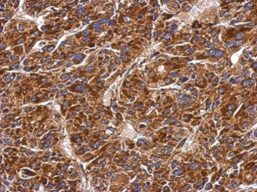 MMAB Antibody in Immunohistochemistry (Paraffin) (IHC (P))