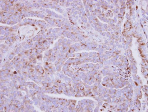 ZDHHC11 Antibody in Immunohistochemistry (Paraffin) (IHC (P))