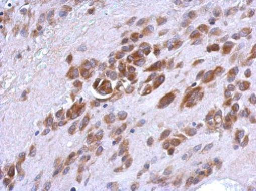 PHF17 Antibody in Immunohistochemistry (Paraffin) (IHC (P))