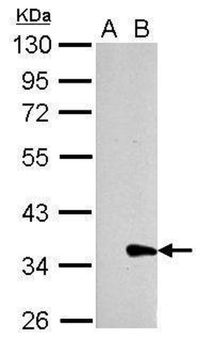 Galectin 8 Antibody in Western Blot (WB)