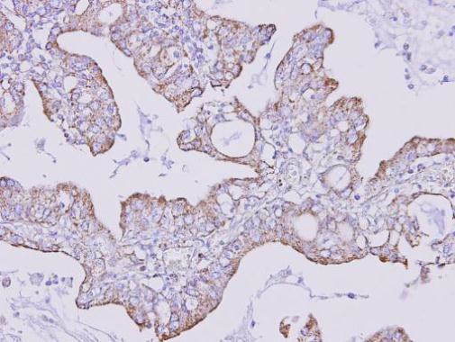 FOXRED1 Antibody in Immunohistochemistry (Paraffin) (IHC (P))