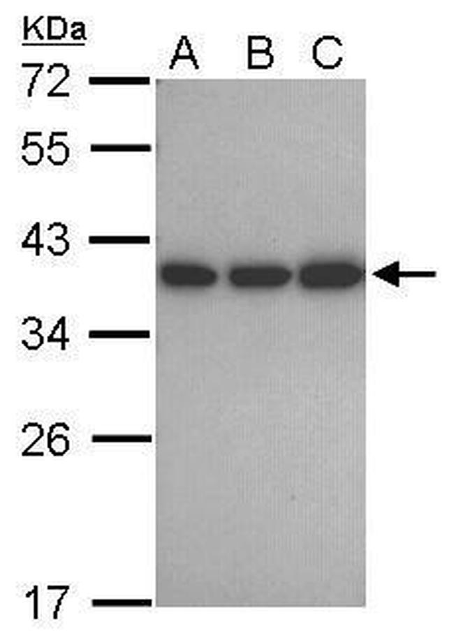 CAPZA1 Antibody in Western Blot (WB)