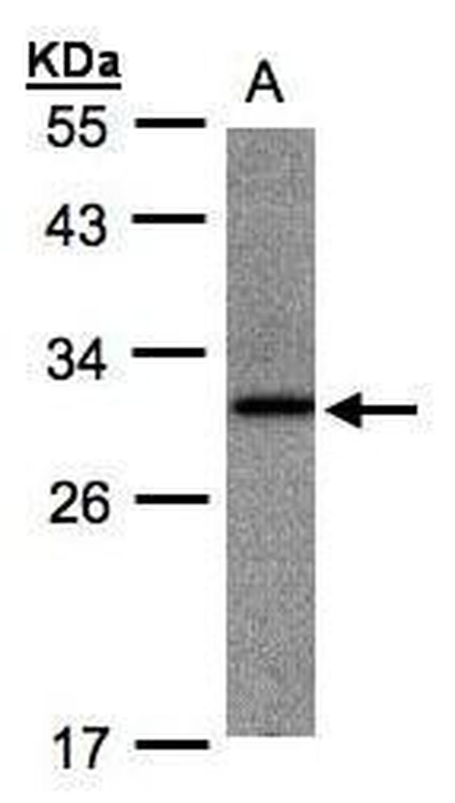 ANKRD7 Antibody in Western Blot (WB)