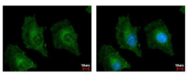 TSPAN3 Antibody in Immunocytochemistry (ICC/IF)