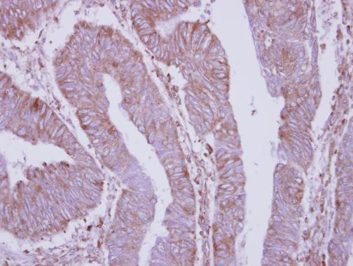 DPY19L4 Antibody in Immunohistochemistry (Paraffin) (IHC (P))