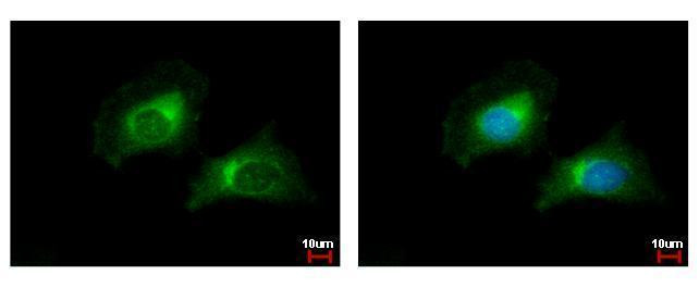 CARD6 Antibody in Immunocytochemistry (ICC/IF)