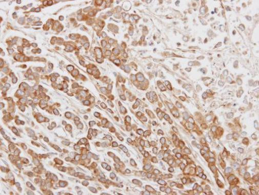 CLPH Antibody in Immunohistochemistry (Paraffin) (IHC (P))