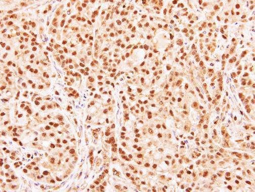 RG9MTD3 Antibody in Immunohistochemistry (Paraffin) (IHC (P))