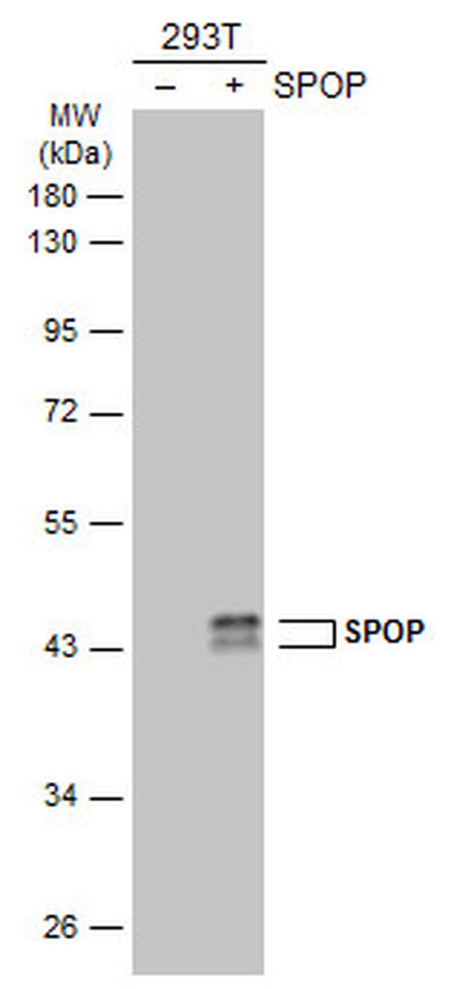 SPOP Antibody in Western Blot (WB)