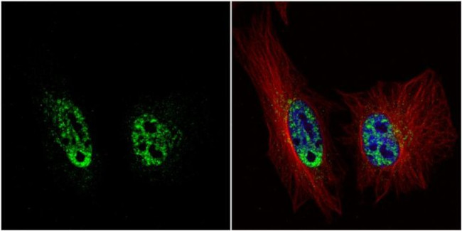 PRP19 Antibody in Immunocytochemistry (ICC/IF)
