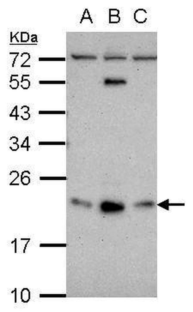 GLIPR1L1 Antibody in Western Blot (WB)