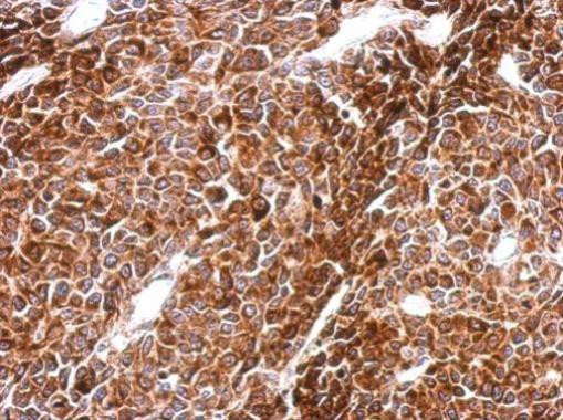 PHF16 Antibody in Immunohistochemistry (Paraffin) (IHC (P))