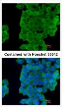Latexin Antibody in Immunocytochemistry (ICC/IF)