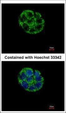 ASB5 Antibody in Immunocytochemistry (ICC/IF)