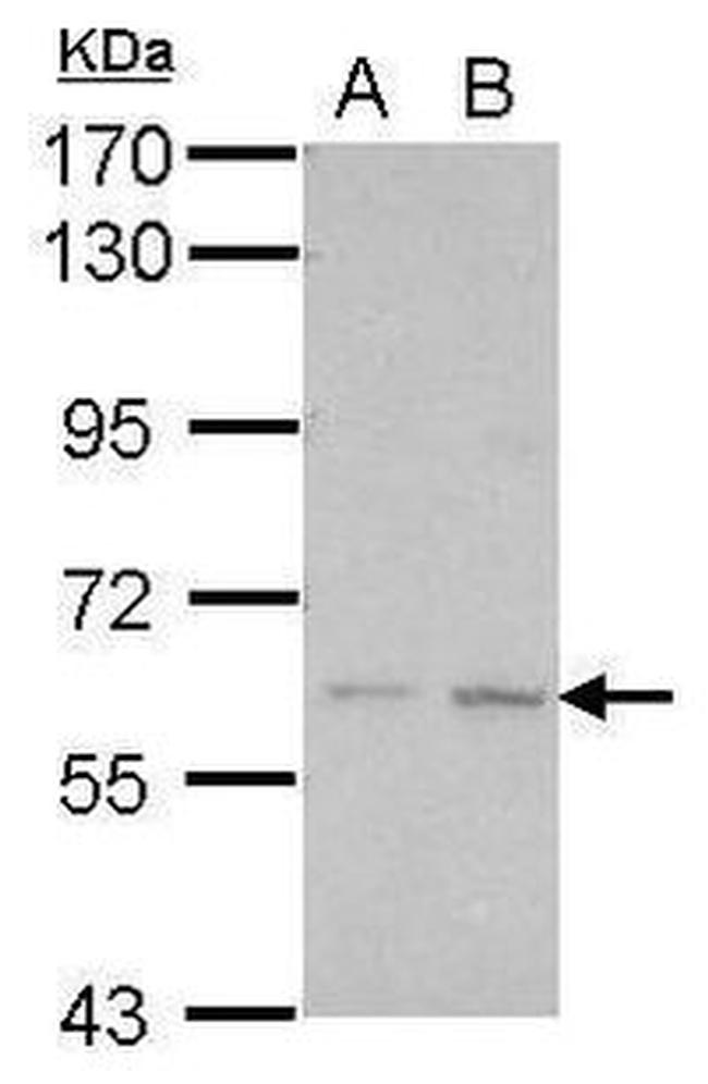 KLHDC7B Antibody in Western Blot (WB)