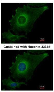 FBXO4 Antibody in Immunocytochemistry (ICC/IF)