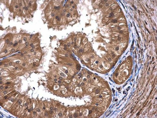 ART5 Antibody in Immunohistochemistry (Paraffin) (IHC (P))